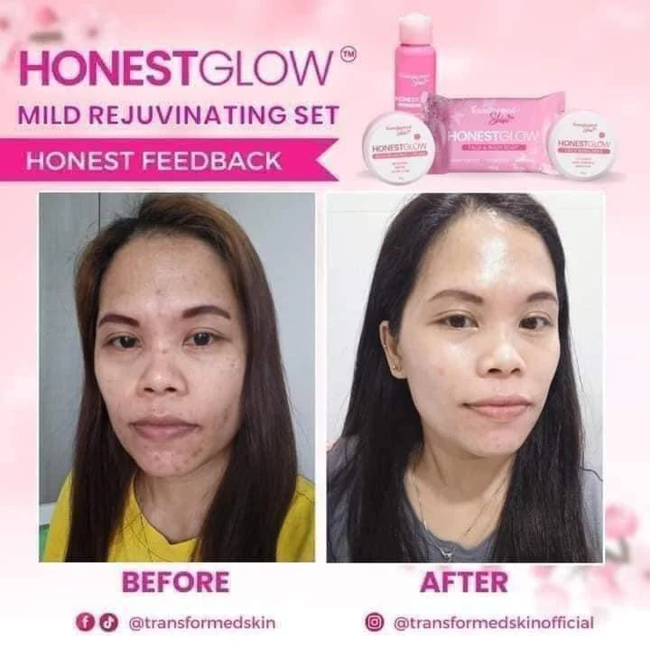 Transformed Skin HonestGlow Facial Set