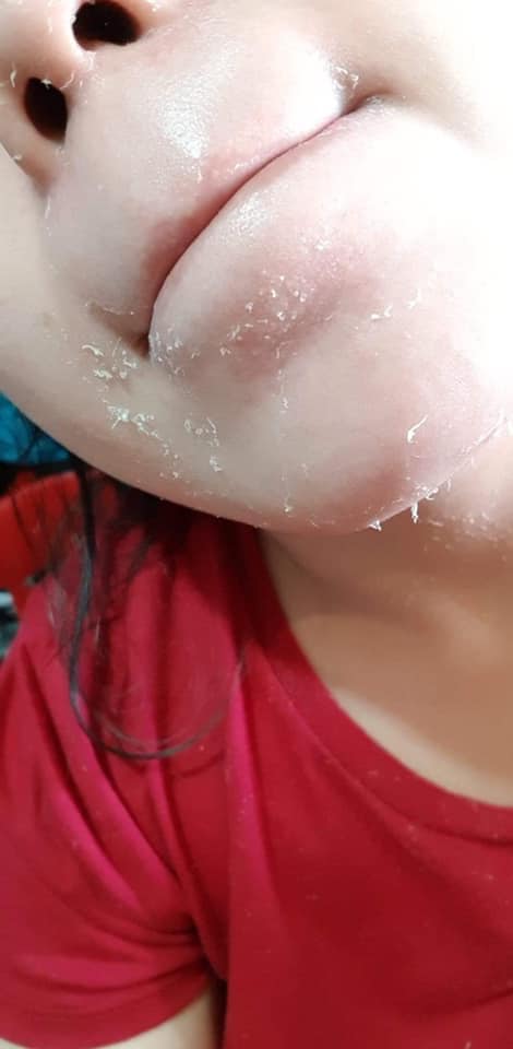 Brilliant Skin Essentials Rejuvenating Set