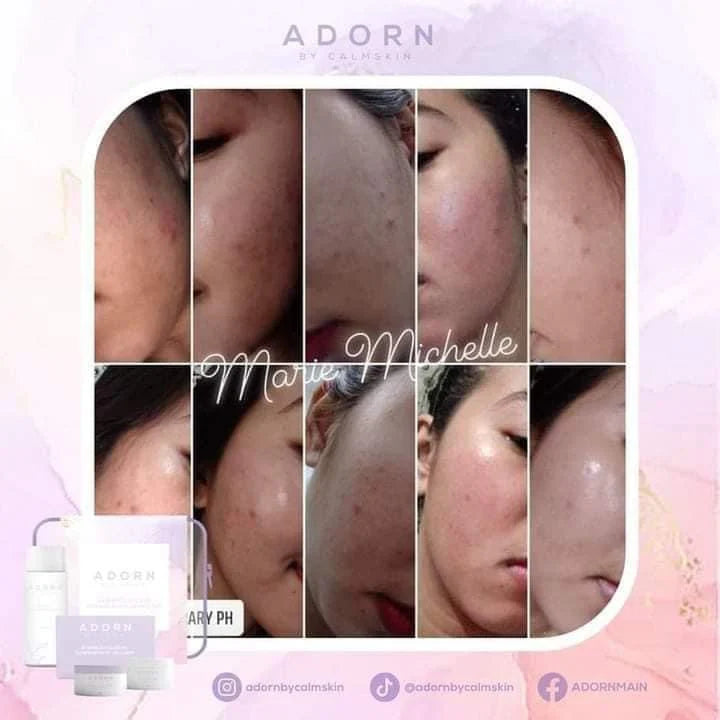 Adorn radiance Intense Exfoliating Set