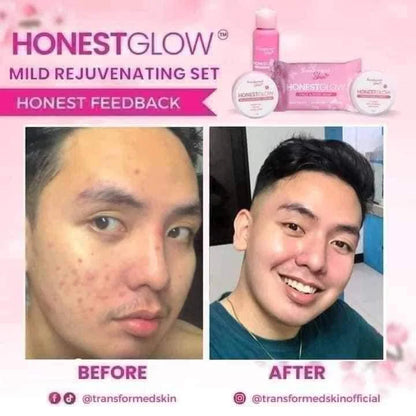 Transformed Skin HonestGlow Facial Set