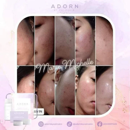 Adorn radiance Intense Exfoliating Set